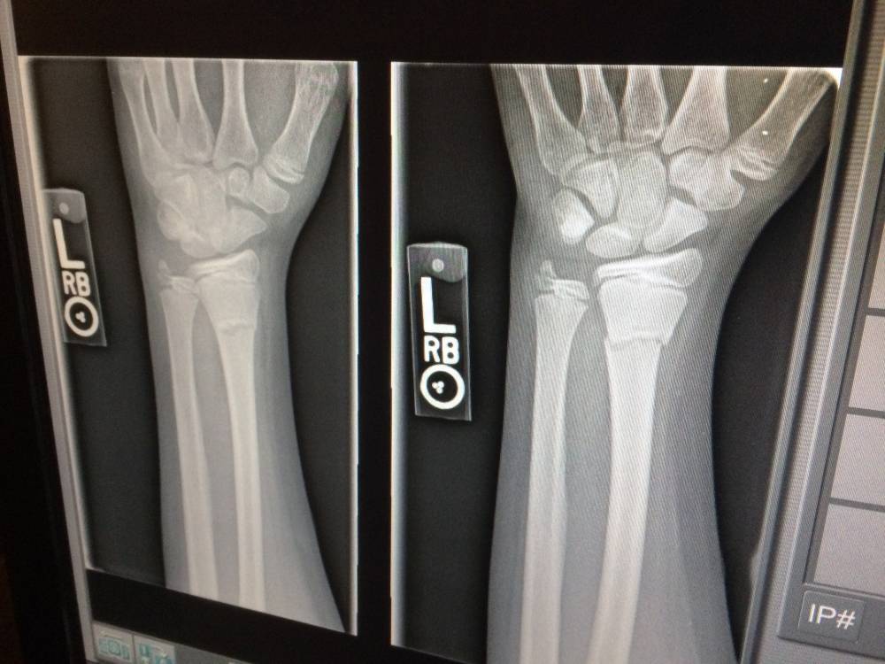 Radiologie près de Ispoure